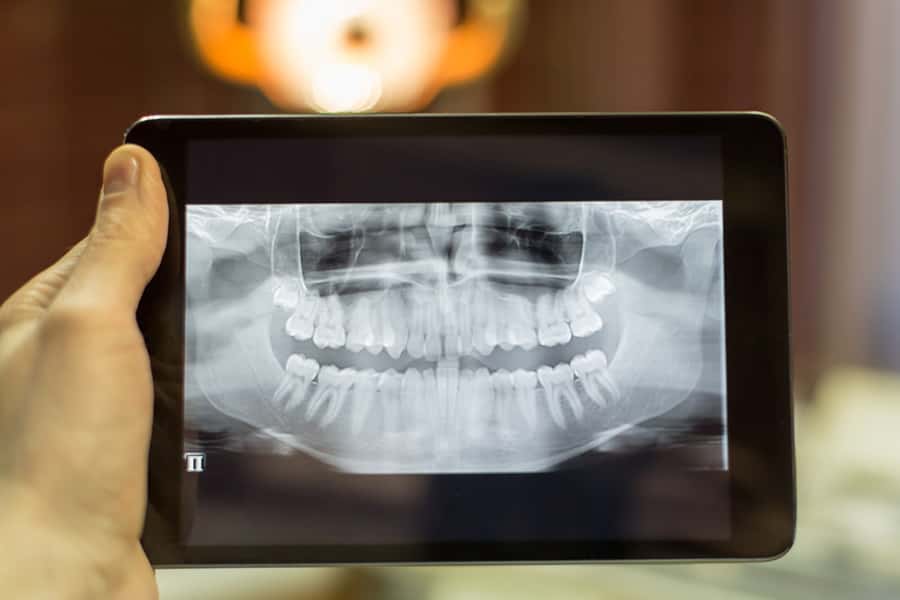 Dental X-Rays in South Holland, IL near 60409